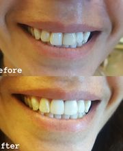 Barlow Family Dentistry image 10