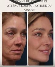 ALPINE SKIN CLINIC / Dr ZD CLINIC Bild 9