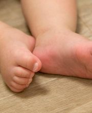 Kindervoet