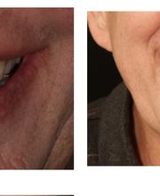 Aspen Ridge Dental image 10