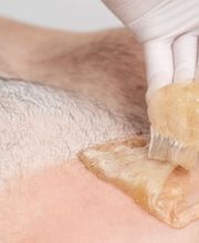 Sanfte Brustenthaarung - Simply Sugar - Haarentfernung so einfach wie möglich - Hamburg