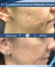 Revitalize SkinMD image 2
