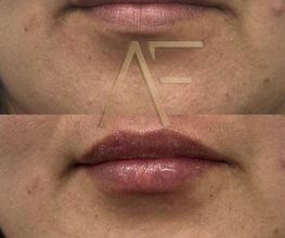 Dr Alexis Fernandez | Medicina Estetica imagen 8