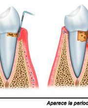 periodoncia2.jpg