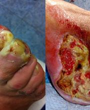 Consulta Barreiro-Vascular (Drs. A. Barreiro Mouro y J. Barreiro Veiguela) imagen 8