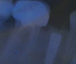 Clínica Dental Quart imagen 5