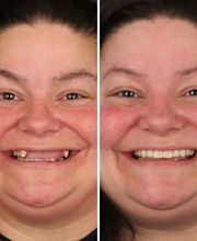 Britely Dentures + Implants Studio image 5