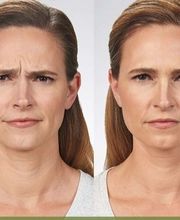 Schweiger Dermatology Group - Glen Carbon image 1