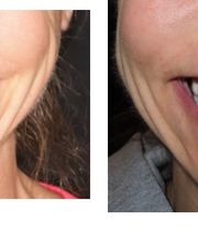 Aspen Ridge Dental image 19