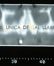 clinica-dental-llambes-radiografias-03.jpg