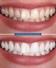 Studio Dentistico Schulthess & Ottobrelli Bellinzona Bild 4