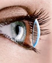 Contactologie Médicale Bild 5