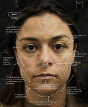 Instituto Marzola | Harmonização Facial imagen 5