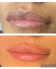 Dinastétique esthéticienne visagiste dermographe image 19