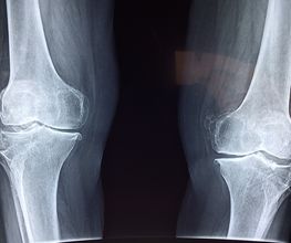 Orthopäde Dr. Michael Prange Bild 2