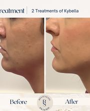 Revitalize SkinMD image 4