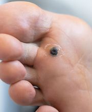 Annapolis Foot & Ankle Center image 11