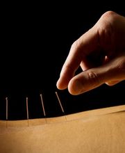 Praxis Für Traditionelle Chin. Medizin TCM Bild 3