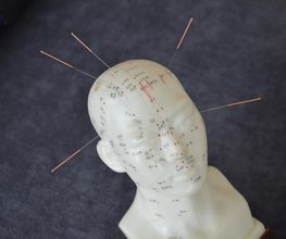 Acupunctuur Gast mw B J