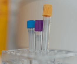 Angiologie Pratteln
