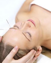 Heal Your Vibe Acupuncture & Wellness image 6