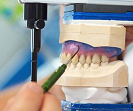 dental-sirera-tratamientos-02.jpg