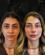 Instituto Marzola | Harmonização Facial imagen 16