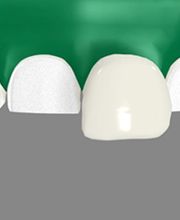 Smile Select Dental Alta Loma image 2