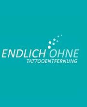 ENDLICH OHNE Tattooentfernung Filiale Ulm Bild 1