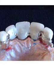 Dentalstudio Peter Häupler e.K. Bild 3
