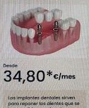 Clínica Dental Vitaldent imagen 3