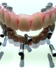 Laboratorio Dental J C imagen 1