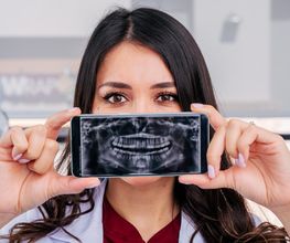 Smilers dental Clinic Sucursal gran vía imagen 12
