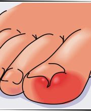 CENTRO DE PODOLOGIA AVANZADA DEL BOZ Y RODRIGUEZ SL imagen 10