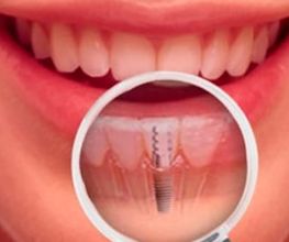 Studio Dentistico Dr. Coler SA Bild 6