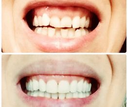 ORTHOLIGHT Orthodontie Bild 6
