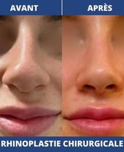 Dr Philippe Legaillard | Chirurgien esthétique Bordeaux | Lifting | Paupières | Rhinoplastie | Augmentation mammaire | Botox image 2
