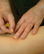 Kinetena - Escuela de Acupuntura y Medicina Tradicional China imagen 3