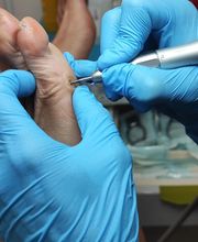 Podología clínica y deportiva Sureste imagen 1