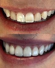 Metro Smiles P.C. image 19