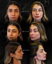 Instituto Marzola | Harmonização Facial imagen 3
