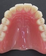 Daniel Wirz Zahnprothetik Bild 5