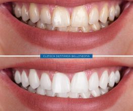 Studio Dentistico Schulthess & Ottobrelli Bellinzona Bild 4