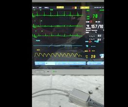 230084394-2-vHUdC6gwhQ1698080163554.jpeg