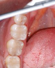 Bodensee Implantatzentrum Dr. Wolfgang Prinz MDSc Zahnarzt/ Implantologie Bild 9