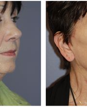 Ethos Plastic Surgery: Ginger Xu, M.D. image 10