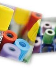 PROXILIS S.A. Bild 2