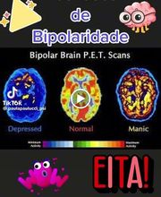Psiquiatra BH - Dr Márcio Candiani - TDAH e Autismo imagen 2