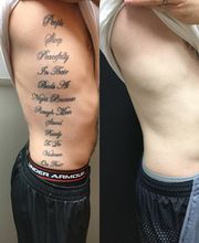 Removery Tattoo Removal & Fading image 1