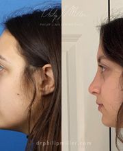 Gotham Plastic Surgery image 10